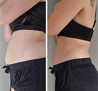 Comparaison avant et après présentée dans la plaquette pour la Méthode Magda